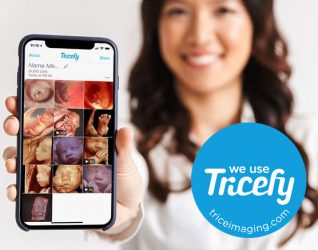 Tricefy-app